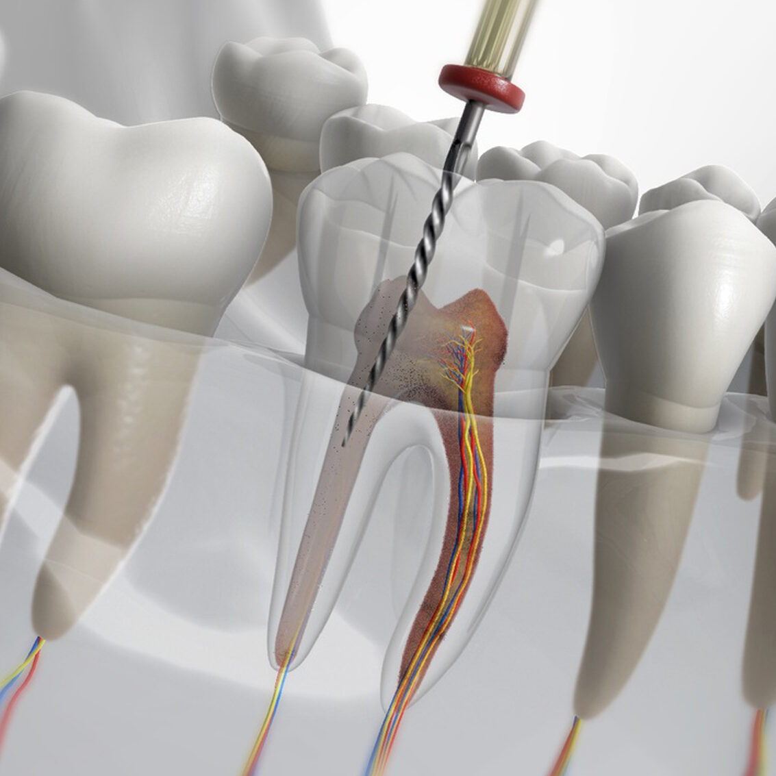 Endodoncia-02