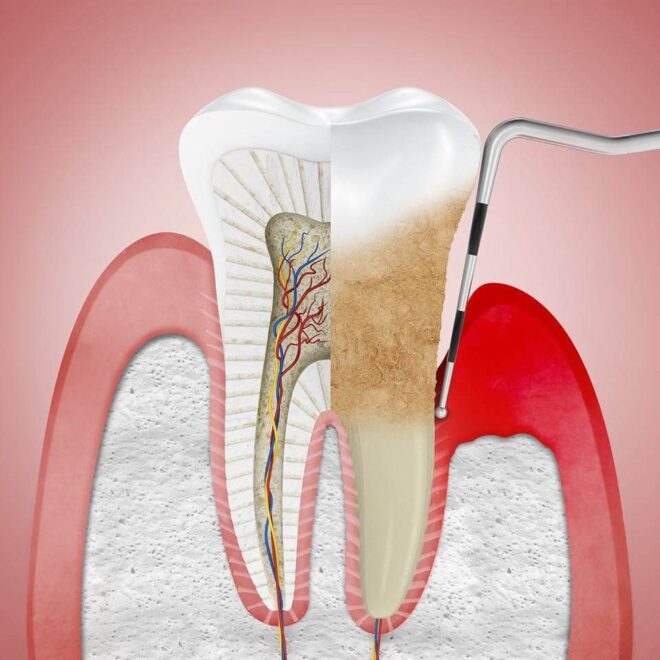 tratamiento-de-periodoncia-1920×960